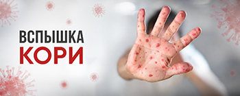 Вспышка КОРИ!